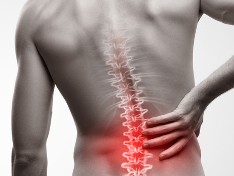 Lomber Disk Herniasyonu