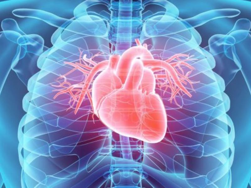 Septal Defekt Onarımları (ASD, VSD, AV Kanal Defekt Onarımı)