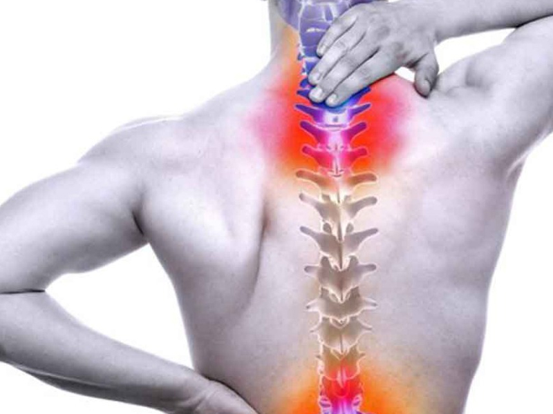 Spinal Stenoz